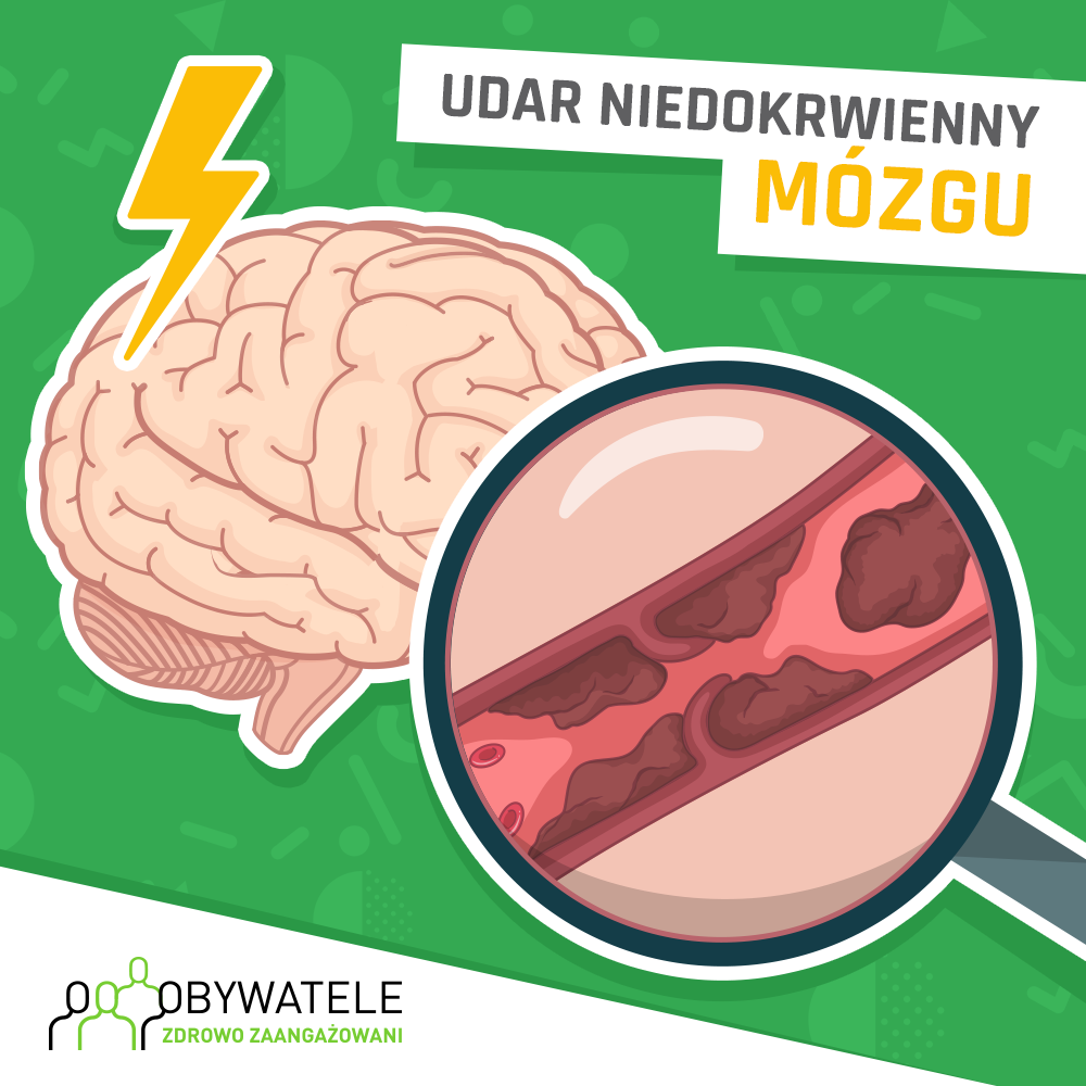 [Blog #36] Udar niedokrwienny mózgu