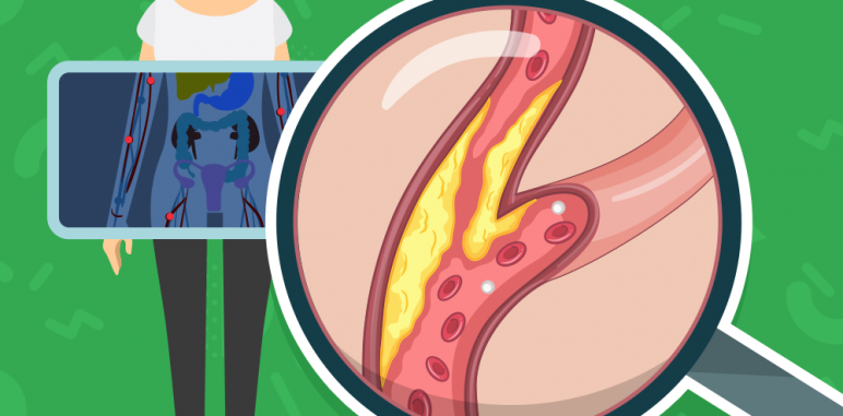 [Blog #42] Cholesterol